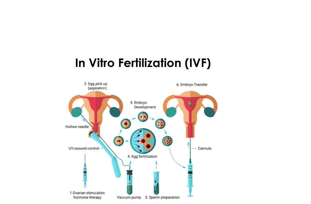 IVF & Fertility Treatment