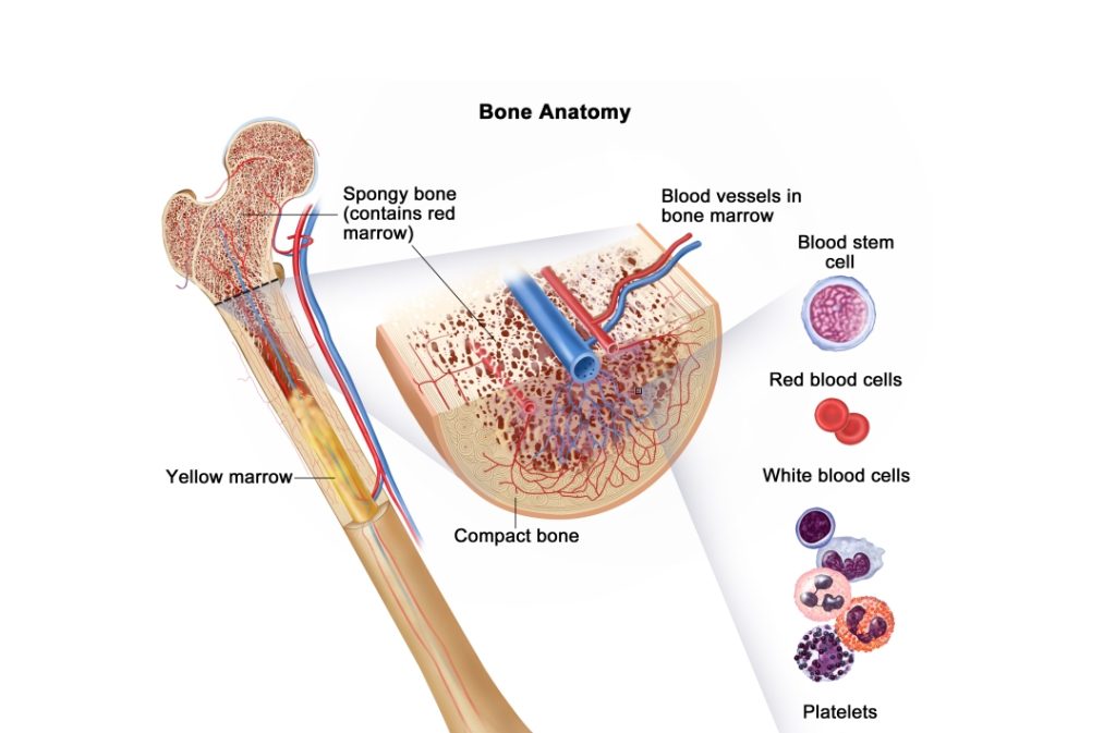 Leukemia Treatment