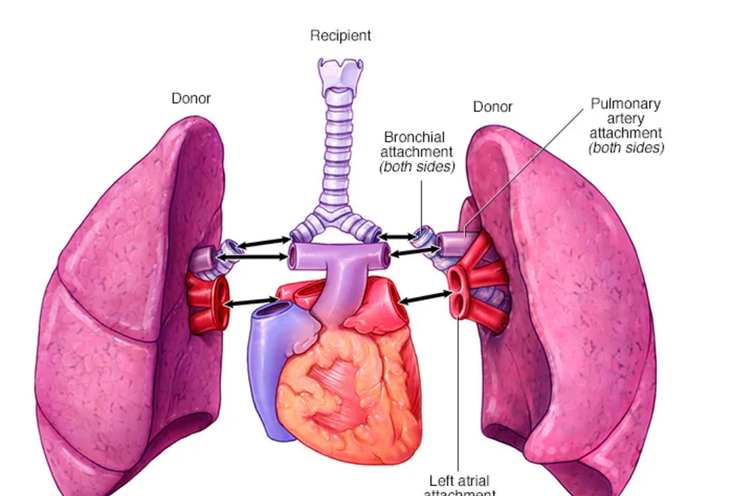 Best Medical Treatments in India for Tanzanians.